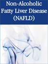 Understanding Non-Alcoholic Fatty Liver Disease