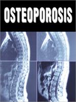 Osteoporosis Live Online Seminar